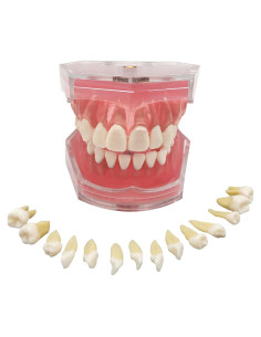 Modelo Dental Estándar YOUYA DENTAL con 28 Dientes Removibles