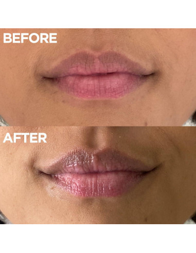 Ungüento Hidratante Lanolips 25g - Piel Seca, Vitamina E