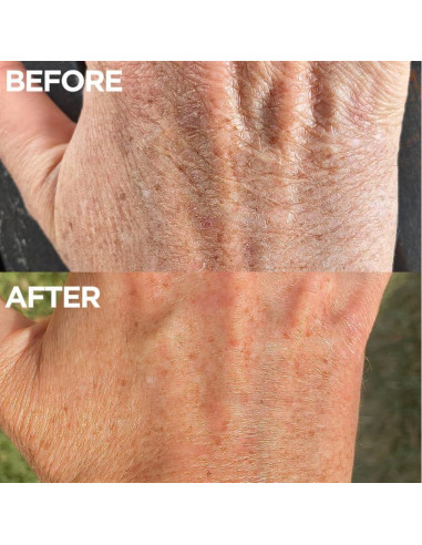 Ungüento Hidratante Lanolips 25g - Piel Seca, Vitamina E