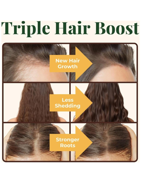 Suplemento Crecimiento Cabello Heebin Biotina 4000 mcg 60 Tabletas