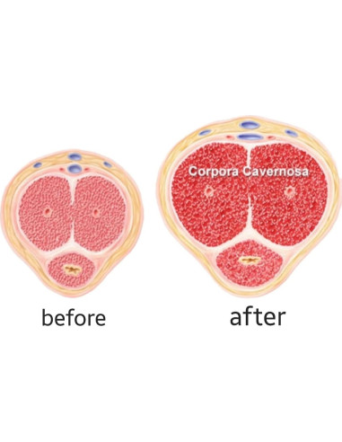 Crema de Crecimiento Rápido Natural Vivid 117g para Hombres