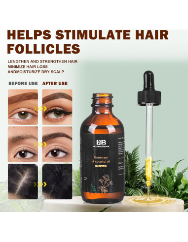 Kit de Crecimiento del Cabello Buybrilliance con Aceite de Romero 56.7ml