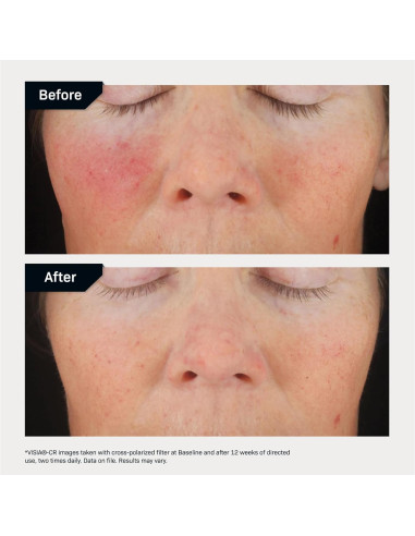 Suero Facial C+ Revision Skincare 30% Antioxidante 28g