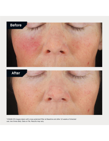 Suero Facial C+ Revision Skincare 30% Antioxidante 28g