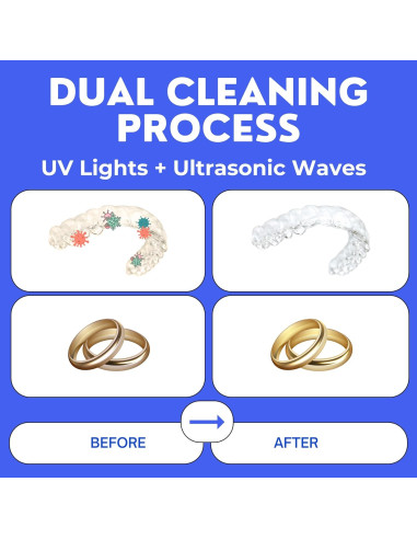Limpiador Ultrasónico UV para Retenedores y Joyería - Hello Bright