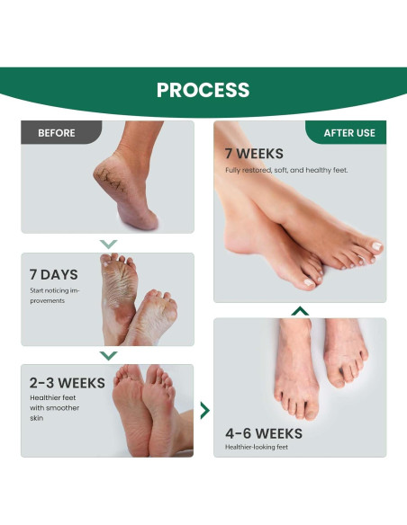 Spray de Jengibre para Pies AIFUFAND - 20ml x 2, Cuidado Natural