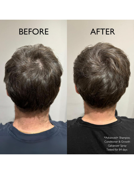 Spray Galvanizador de Crecimiento Capilar Daimon Barber 100ml