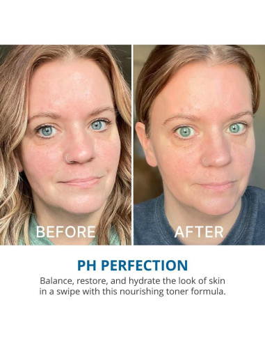 Tónico Hidratante goPure Hit Refresh 321g - pH Equilibrado