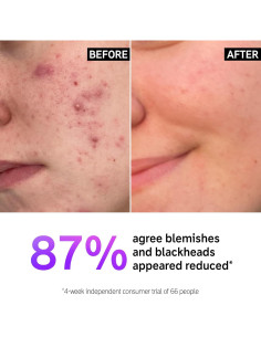 Limpiador Facial Ácido Salicílico The INKEY List 150 ml 2