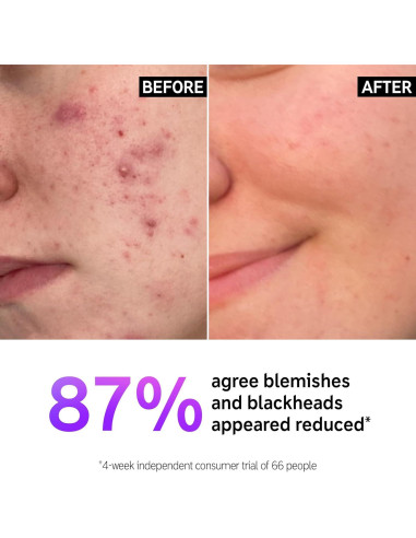 Limpiador Facial Ácido Salicílico The INKEY List 150 ml