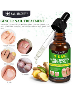 Tratamiento de Hongos en Uñas Fungi Nail 30ml - 2PCS 2