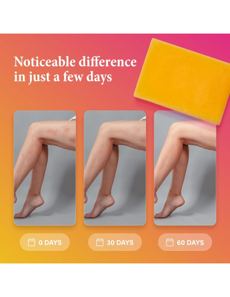 Jabón Ácido Kójico Este Pequeño 2 Paquetes - Vitamina C, Retinol, Colágeno