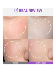 Ampoule Meoru Podo Vita C Sungboon 30 ml - Vitamina C y Niacinamida 2