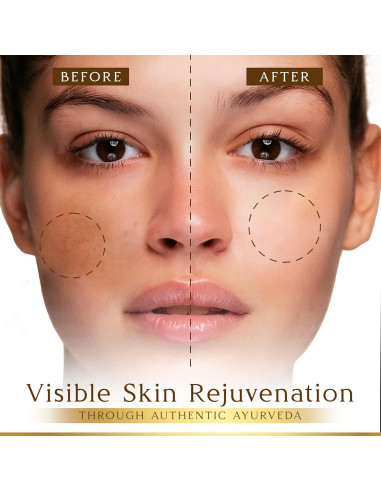 Suero Facial Kumkumadi SESA 30ml - Hidratante y Antienvejecimiento