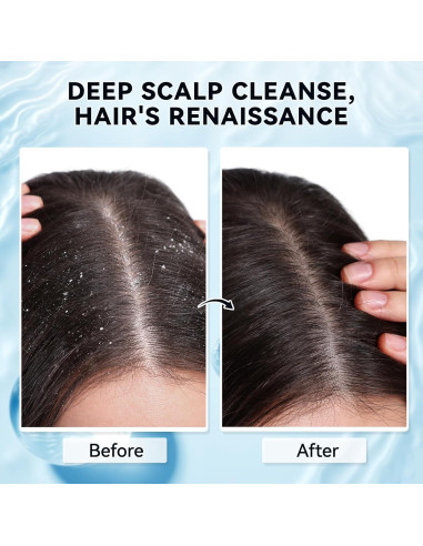 Exfoliante para Cuero Cabelludo Mokasakiso 240g - Limpieza Profunda