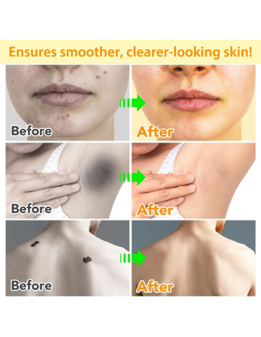 Crema Hidratante de Veneno de Abeja Newseel 150g - Reparadora