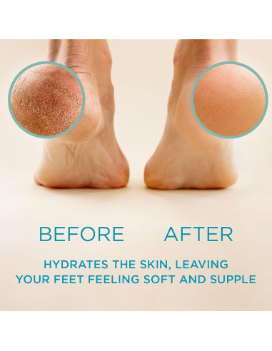 Removedor de Callos Lee Beauty Professional - Gel 226.8 g