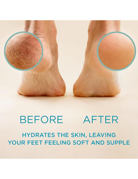 Removedor de Callos Lee Beauty Professional - Gel 226.8 g