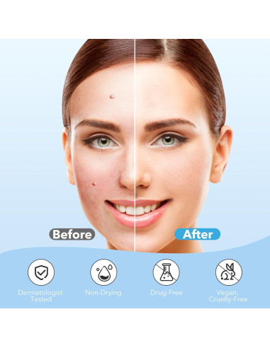 Parches para Granos QUSTERE Hidrocoloide 288 Unidades 9mm 12mm