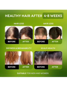 Aceite de Batana RICHGRAND 100% Orgánico para Crecimiento Capilar 2