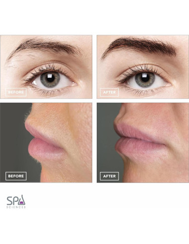 Removedor de Vello Facial 2 en 1 Spa Sciences AIVA LED