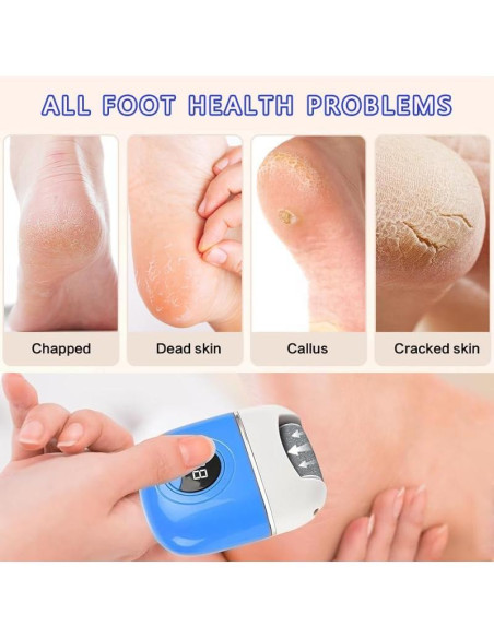 Removedor de Callos Eléctrico Zhanpinc con Pantalla Digital
