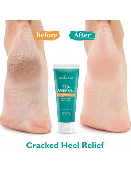Gel de Urea 42% Gilden Tree para Pies 113.4g Suaviza Callos Gel de Urea 42% Gilden Tree para Pies 113.4g Suaviza Callos