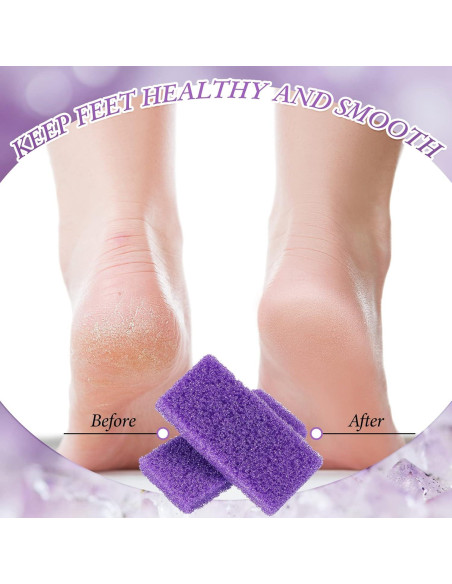 200 Piezas Piedra Pómez Exfoliante para Pies Dunzy 9x4.5cm