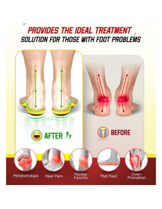 Plantillas Ortopédicas NEUPU para Fascitis Plantar XL Azul 2