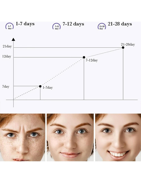 Crema Removedora de Manchas Oscuras Niacinamida 20g