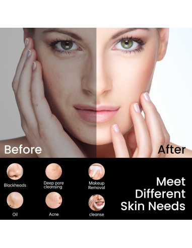 Exfoliador Facial Eléctrico Kpyphm Recargable IPX7 Negro