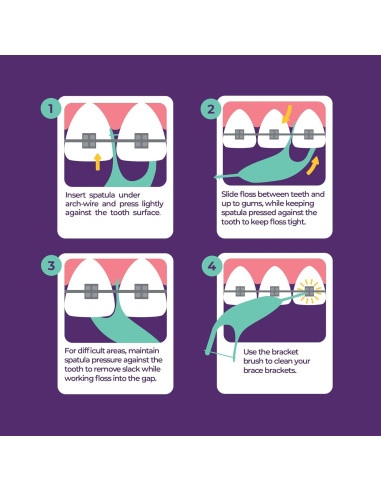 Flossers Ortodónticos Platypus para Brackets - 40 Unidades