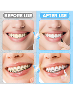 120 Cepillos Interdentales MAPVOLUT, Limpieza Oral Eficaz 2