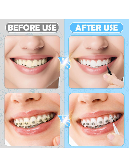 120 Cepillos Interdentales MAPVOLUT, Limpieza Oral Eficaz