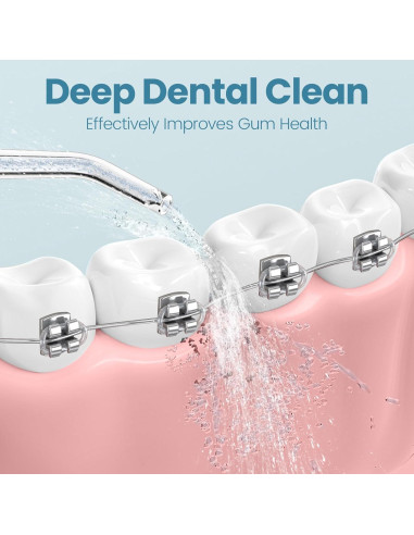 Cabezas de Repuesto Onlyone Water Flosser FC5090 - 5 Piezas