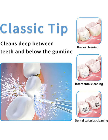 Cabezas de Repuesto Waterpik - 2 Puntas Clásicas para Irrigador Dental