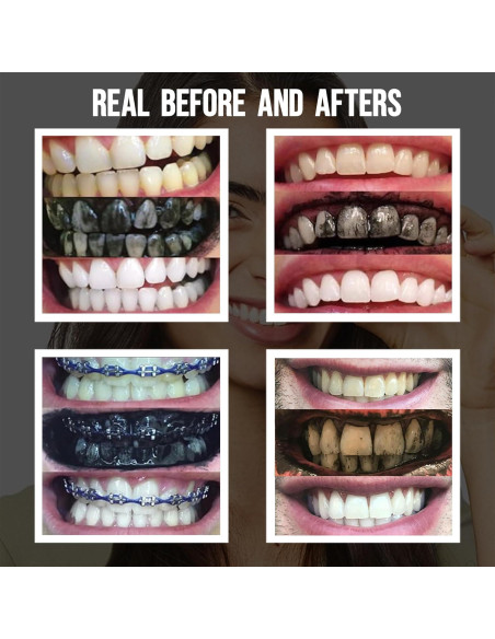 Polvo Blanqueador Dental de Carbón Activado Blkdiamond 59g