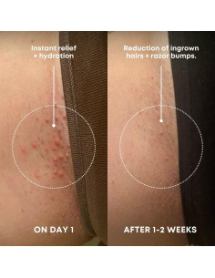 Exfoliante Corporal Bushbalm Azúcar de Sandía 227g - Vellos Encarnados 2