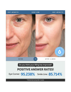 Suero Profundo Antártico Serumkind 30 ml - Lifting y Voluminizador Vegano 2