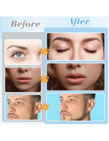 Rasuradora Dermaplane ProSuites 16 Piezas para Mujeres