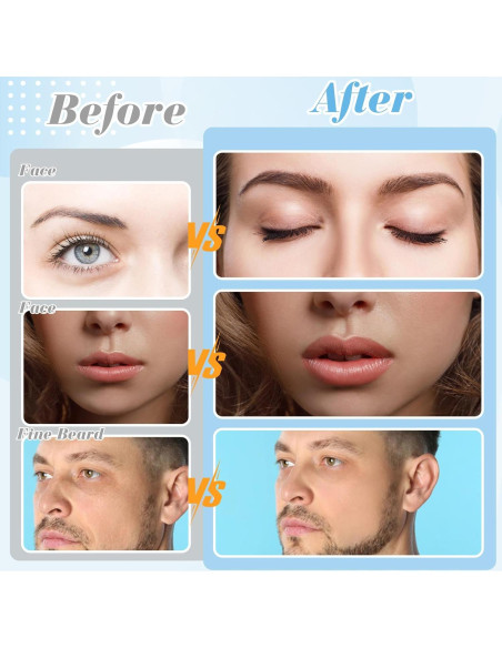 Rasuradora Dermaplane ProSuites 16 Piezas para Mujeres