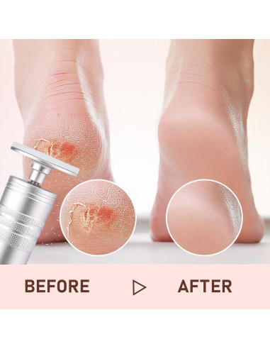 Removedor de Callos Eléctrico Kredioo con Lima de Vidrio Nano