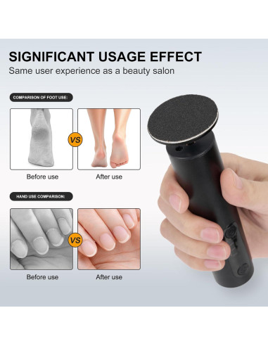 Removedor de Callos Eléctrico Cesekao Obsidiana 9 Velocidades