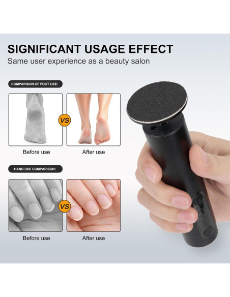 Removedor de Callos Eléctrico Cesekao Obsidiana 9 Velocidades