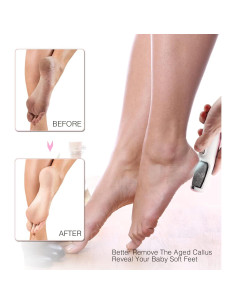 Removedor de Callos Eléctrico AM 8:00 Rosa, Recargable con Luz LED 2