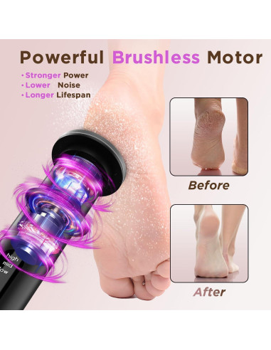 Removedor de Callos Eléctrico Ssoiew MJQ01 con 60 Discos