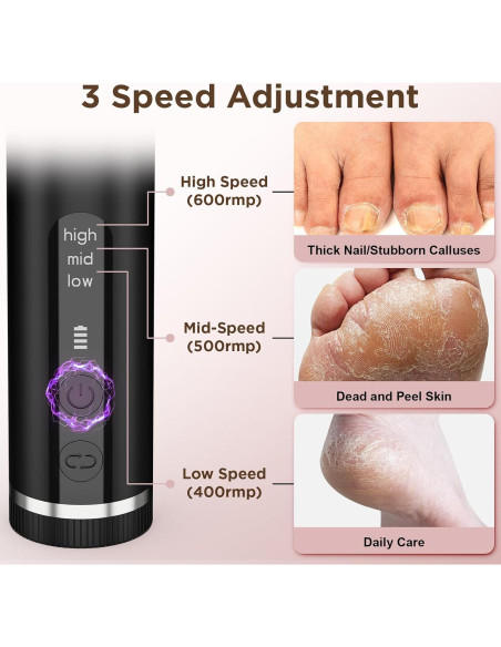 Removedor de Callos Eléctrico Ssoiew MJQ01 con 60 Discos