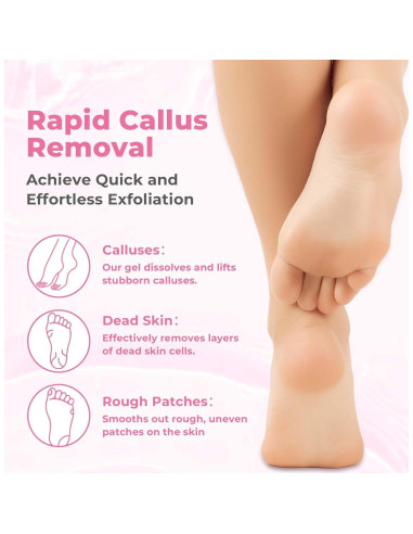 Removedor de Callos Saisze Gel Profesional 227g con Cepillo