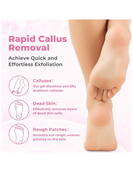 Removedor de Callos Saisze Gel Profesional 227g con Cepillo Removedor de Callos Saisze Gel Profesional 227g con Cepillo