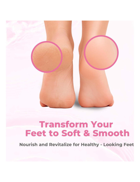 Removedor de Callos Saisze Gel Profesional 227g con Cepillo Removedor de Callos Saisze Gel Profesional 227g con Cepillo